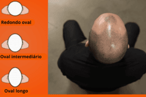 Tipos de medidas da cabeça para escolher capacete